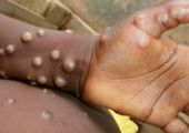 کمک به پیشگیری از سرطان، هدف جدید بانک آینده در حوزه سلامت است