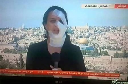 چهره عجیب خبرنگار زن در پخش زنده اخبار +عکس
