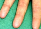 مواجهه پلیس با زن عجیبی که اثر انگشت نداشت + عکس 